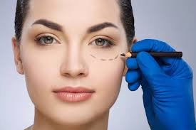 Lifting facial — imagen ilustrativa